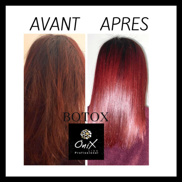 Botox onix – Image 2